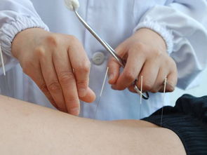 两部委推动科技创新 丰富中医药健康服务 社区推拿助力全民健康